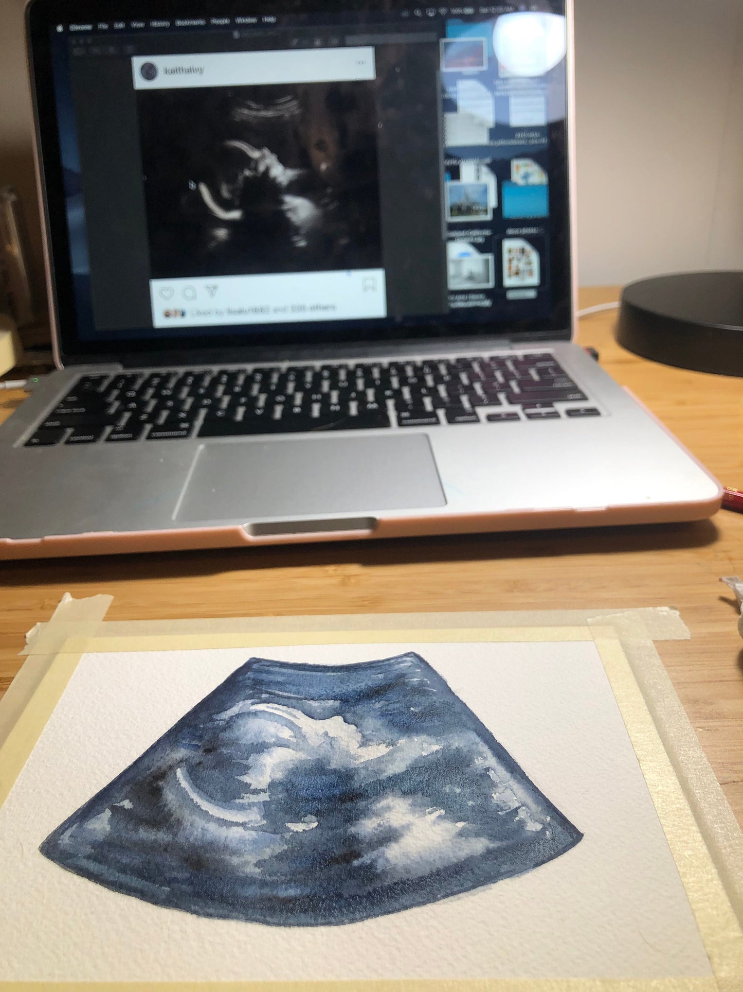 Custom Watercolor Ultrasound Painting, Sonogram Painting