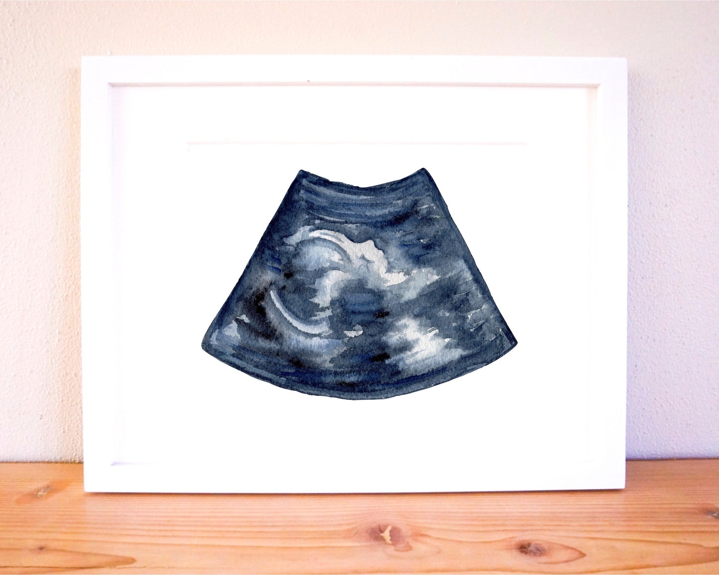 Custom Watercolor Ultrasound Painting, Sonogram Painting