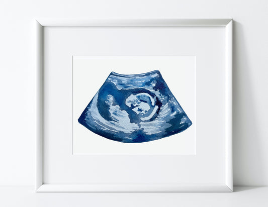 Custom Watercolor Ultrasound Painting, Sonogram Painting